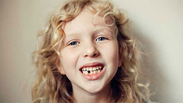 Dental-care-teeth - Kindersley Clarion dental care plan healthcare