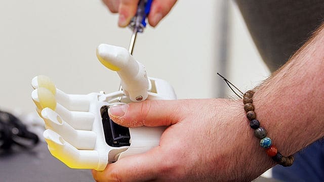 Prosthetics - Kindersley Clarion AI (artificial intelligence) revolutionizes prosthetic by creating adaptive partners that enhance user interactions